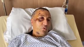 "La peur doit vraiment changer de camp": en vidéo depuis son lit d'hôpital, un policier blessé à la tête sort du silence