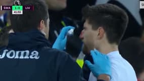 Fernandez et son nez cassé