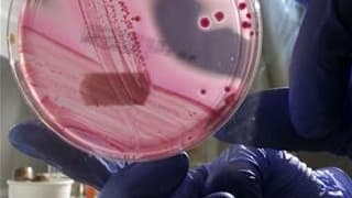 Echantillon de la bactérie Escherichia coli, qui a causé 14 décès en Allemagne et s'est répandue dans plusieurs pays du nord de l'Europe. La France a demandé mardi à Berlin et à l'Espagne, point de départ possible mais non encore certain de la contaminati