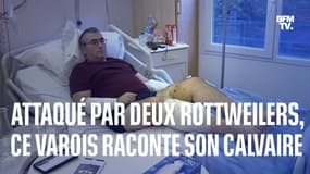 Attaqué par deux rottweilers lors de son footing, ce Varois raconte son calvaire