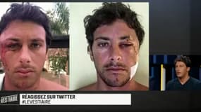 Jérémy Florès raconte son terrible accident dans Le Vestiaire