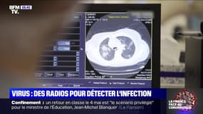 Coronavirus: des radios du thorax permettent de détecter l'infection dans un hôpital à Strasbourg