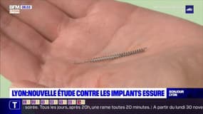 Lyon: une nouvelle étude confirme la nocivité des implants Essure