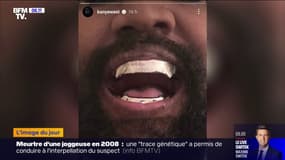 Kanye West dévoile ses nouvelles dents en titane à 780.000 euros