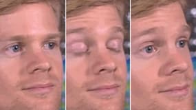 Le mème "Blinking White Guy"