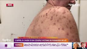Ce couple est envahi de punaises de lit depuis un an