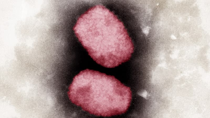 la France prend-elle suffisamment la mesure de l'épidémie de variole du singe?