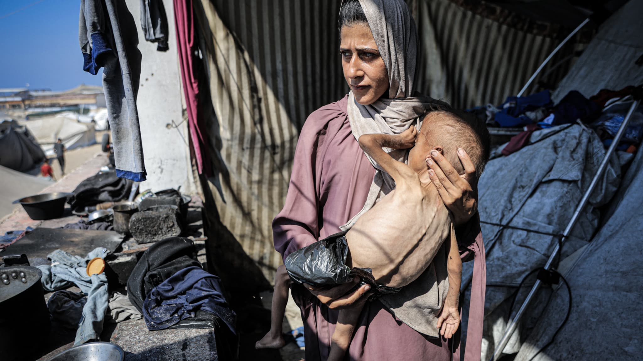 Un enfant d'un an et demi de la ville de Gaza, pesant 6kg en raison de la malnutrition dans la bande de Gaza, le 21 juillet 2025.