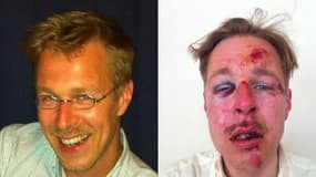 Wilfred de Bruijn, à gauche, a posté sur Facebook une photo de lui après l'agression