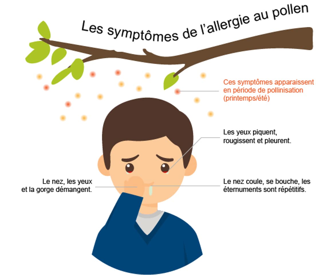 Alerte Au Pollen Si Vous Avez Ces Symptômes Vous Souffrez Peut être Dallergie 