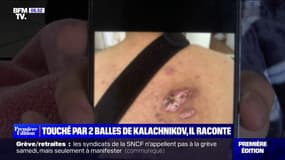 Marseille: ce chauffeur VTC a été touché par deux balles de kalachnikov 