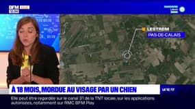 Pas-de-Calais: une petite fille de 18 mois grièvement blessée après avoir été mordue par un chien à Lestrem