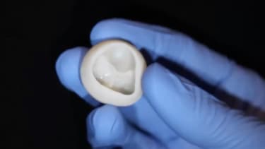 Une valve cardiaque fonctionnelle