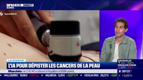 Ali Khachlouf (SquareMind) : L'IA pour dépister les cancers de la peau - 04/10