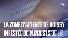 La zone d'attente de l'aéroport Roissy-Charles-de-Gaulle infestée de punaises de lit