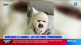 Explosion d'une lampe éthanol à Cannes: Lorenzo, une des victimes, témoigne