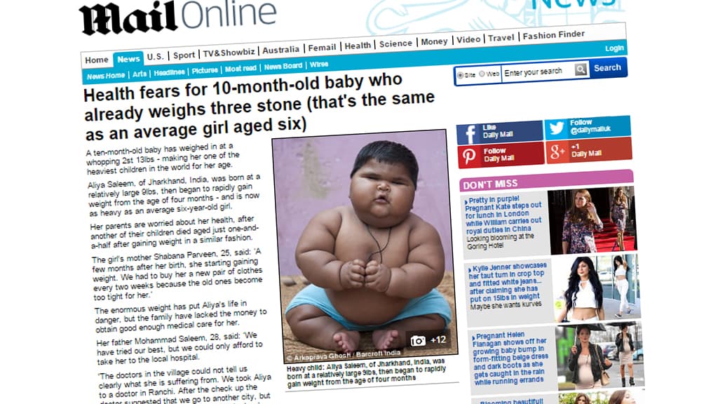 En Inde Un Bebe De 10 Mois Pese 18 Kg