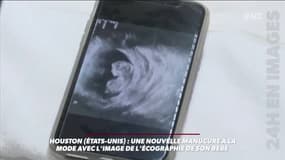 Etats-Unis: et si vous vous offriez une manucure... de l'échographie de votre bébé?