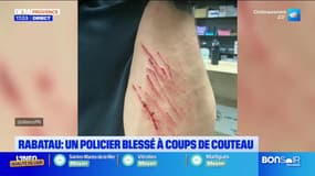 Marseille: un policier blessé à l'arme blanche boulevard Rabatau lors d'une interpellation