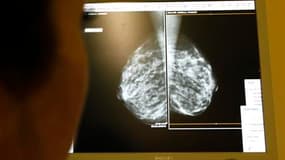 Le cancer de la prostate chez l'homme et du sein chez la femme sont les plus fréquents en France, où le cancer du poumon fait aussi des ravages. /Photo d'archives/REUTERS/Eric Gaillard