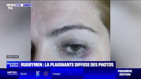 Affaire Jégou-Auradou: la presse argentine révèle des photos de la plaignante 