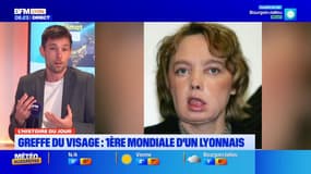 Il y a 20 ans, un professeur lyonnais réalisait la première greffe mondiale du visage 