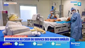 Hôpital de la Conception. Immersion au cœur du service de grands brûlés