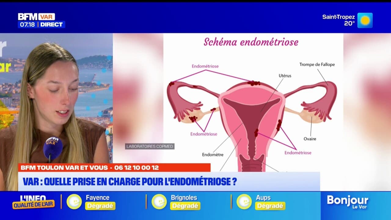 BFM Var et Vous: quelle prise en charge pour l'endométriose dans le département?