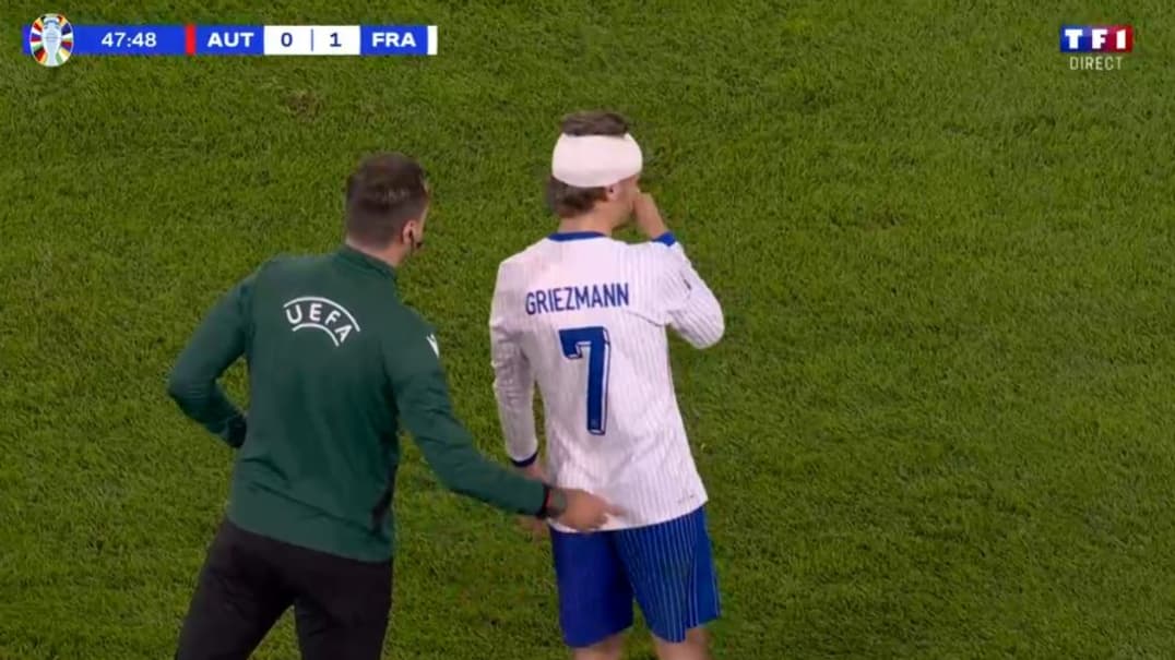 Franche-Autriche: les images de Griezmann avec le front en sang après un choc contre le panneau publicitaire, le 17/06/2024 Franche-Autriche: les images de Griezmann avec le front en sang après un choc contre le panneau publicitaire, le 17/06/2024