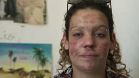 "Crack, l'enfer de la drogue": comment une accro s'est métamorphosée à cause de sa consommation