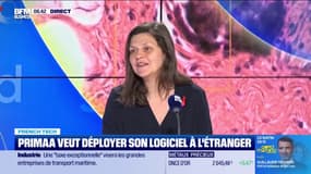 Primaa aide à détecter le cancer du sein