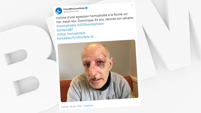 Le sexagénaire agressé à La-Roche-sur-Yon.