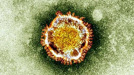 Le coronavirus MERS vu au microscope.