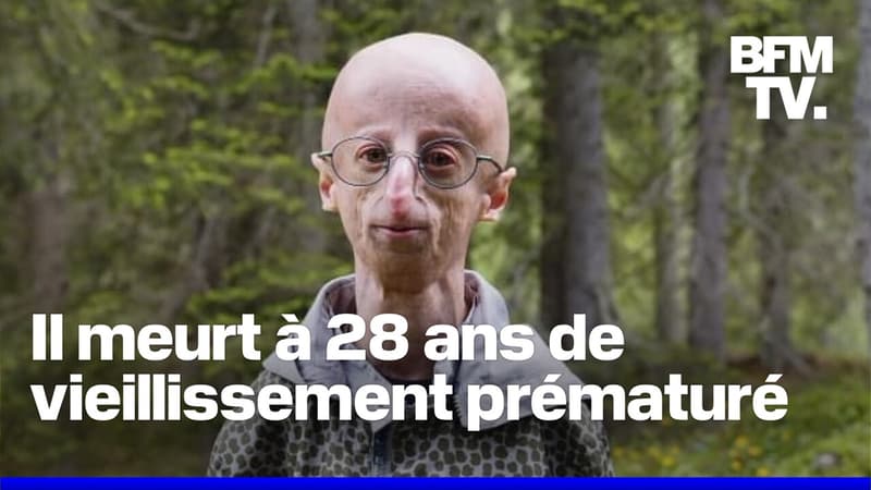 À 28 ans, Sammy Basso, le plus vieux malade au monde atteint de vieillissement prématuré est mort