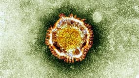 Le coronavirus vu au microscope - Image d'illustration