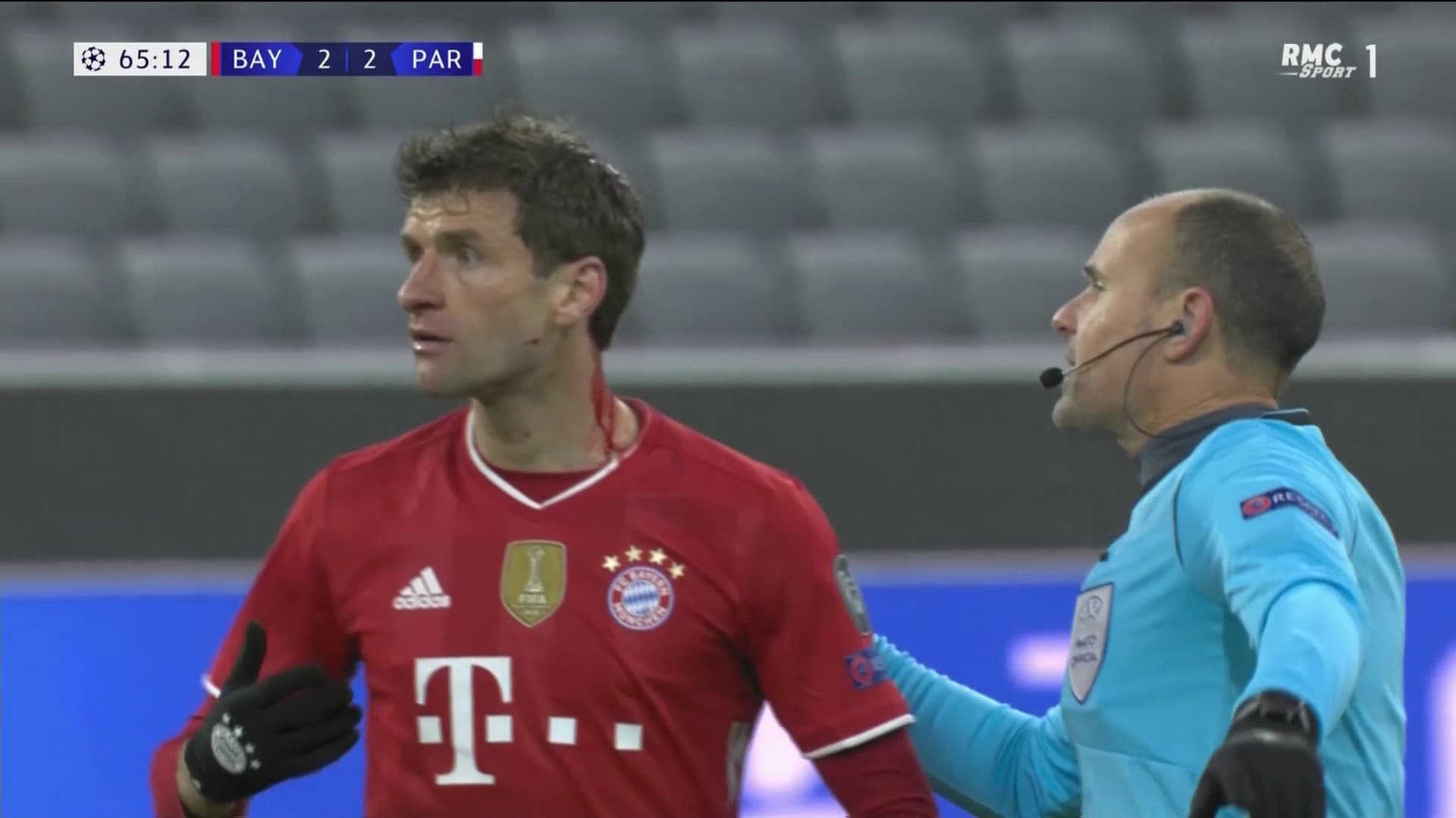 Thomas Müller ne s'est pas rendu compte qu'il saignait Thomas Müller ne s'est pas rendu compte qu'il saignait