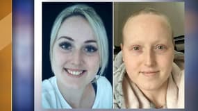 Sarah Boyle avant et après le début de la chimiothérapie
