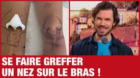 C'est tous les jours Demanche : se faire greffer un nez sur le bras - 24/11