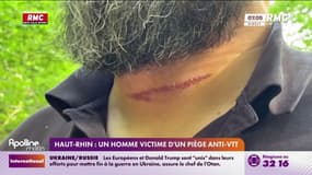 Haut-Rhin : un cycliste blessé par un piège anti-VTT