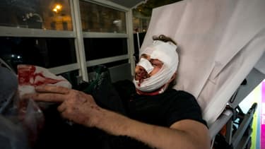 Le photographe syrien Ameer al-Halbi, blessé à Paris, le 28 novembre 2020 lors de la manifestation contre le texte de loi "sécurité globale" et les violences policières