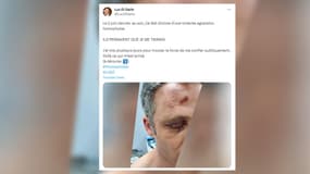 L'élu a partagé la violente agression homophobe dont il a été victime au début du mois.