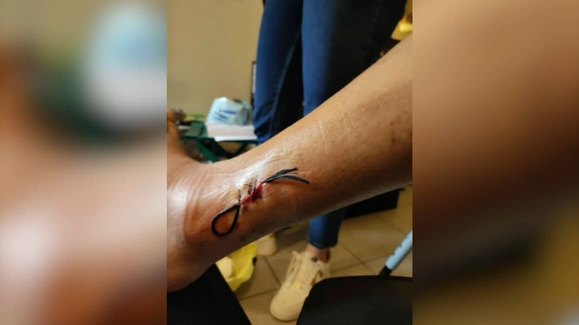 La blessure de Mathias, le 28 mars 2023 La blessure de Mathias, le 28 mars 2023