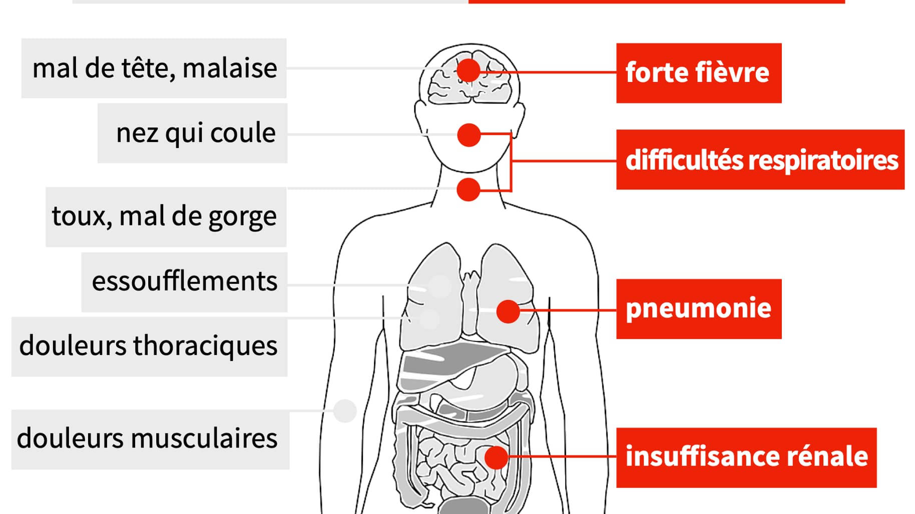 Les symptômes du coronavirus Les symptômes du coronavirus
