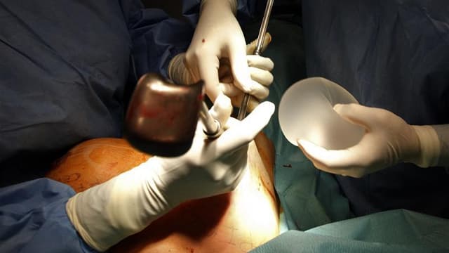 Partie de France, l'affaire des prothèses mammaires défectueuses prend une dimension mondiale tandis que l'étau se resserre autour des dirigeants de la société française Poly Implant Prothèse (PIP), à l'origine des implants incriminés, portés par des cent