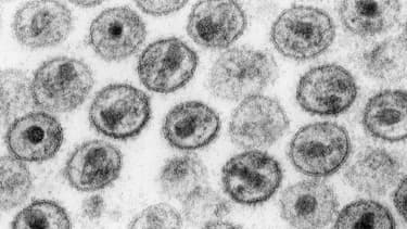 Le VIH vu en microscopie électronique à transmission.