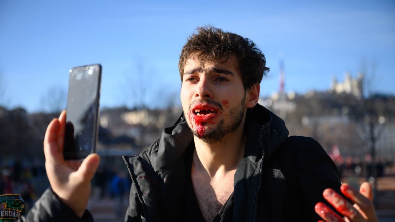 agressionLyonmanif2.jpg
