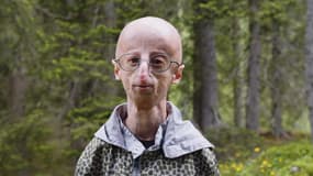 Sammy Basso, un Italien malade de la progéria (ou syndrome de Hutchinson-Gilford), maladie du vieillissement prématuré, en 2023.