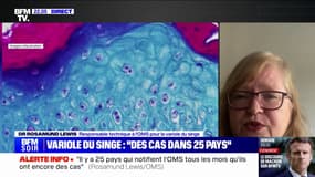 Rosamund Lewis (responsable technique à l'OMS pour la variole du singe): "Il y a 25 pays à peu près qui notifient l'OMS chaque mois qu'ils ont encore des cas de variole simienne"