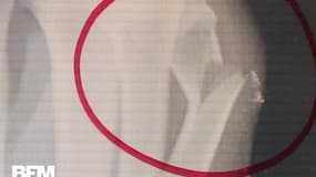 Une exposition dans un hôpital de Milan pour dénoncer les violences conjugales