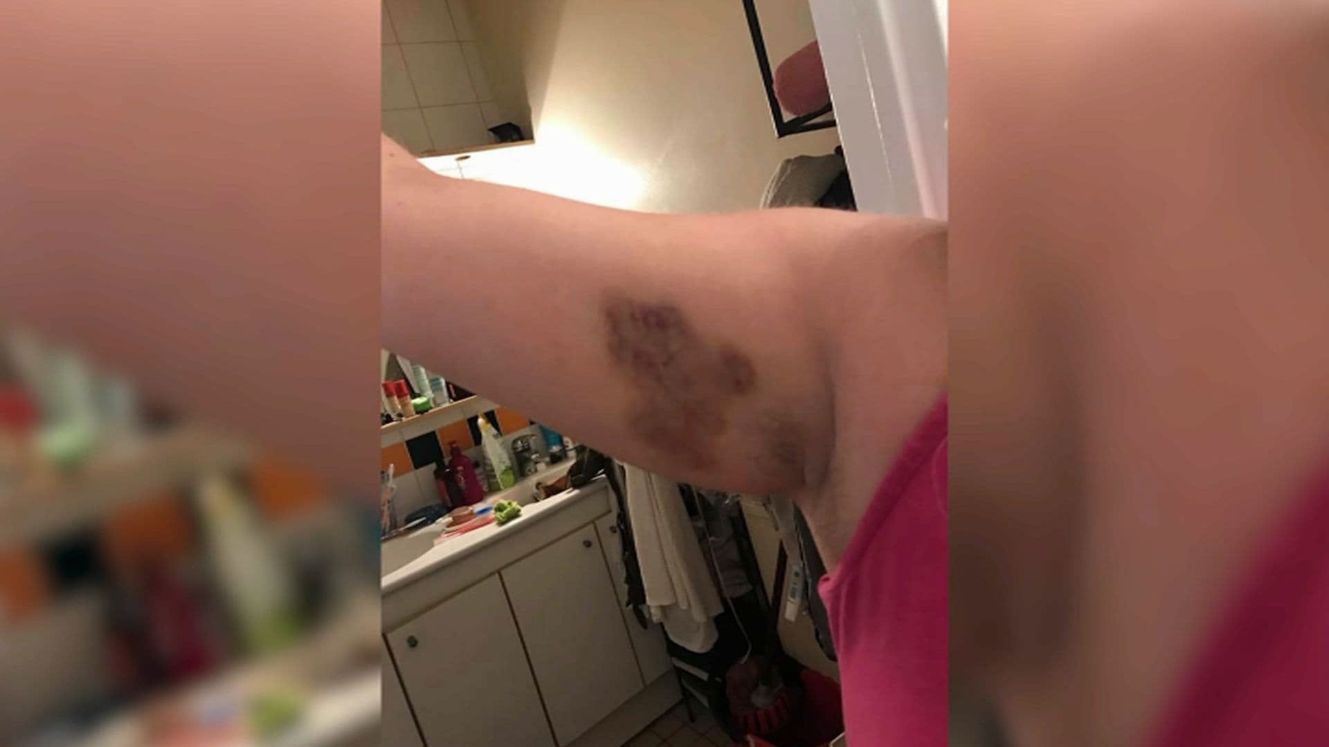 Les blessures de la mère de famille lui ont valu une ITT de 8 jours.